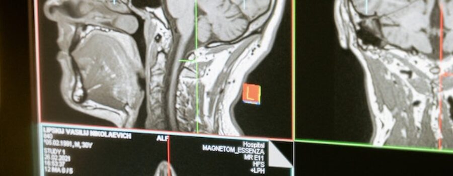 X-ray Radiation Exposure: A Biological Dentist’s Perspective